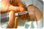 New York anesthesia accident attorneys