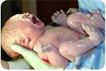 New York birth injury accident attorneys