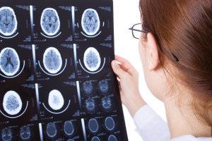 Medical Malpractice: Brain Damage 