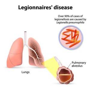 Legionnaires' diseas