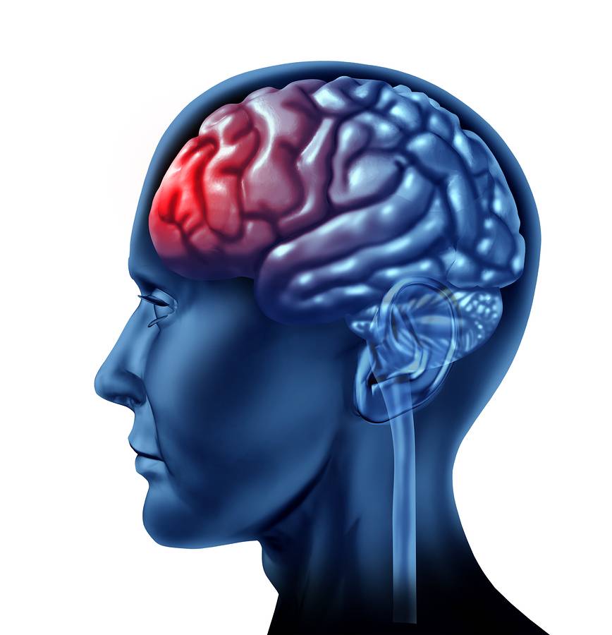 traumatic brain injury