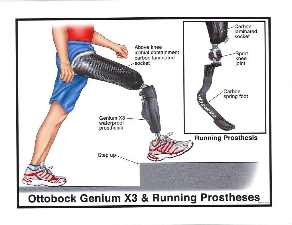 Exhibit M — Ottobock Genium X3 & Running Prosthesis 