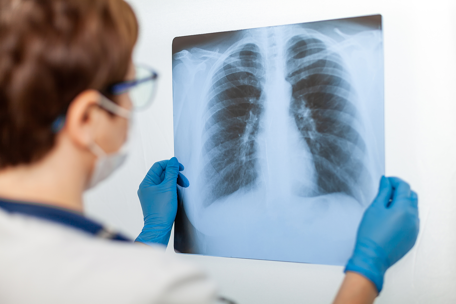 silicosis-lawsuit